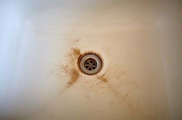 Old dirty kitchen sink. Enamel surface with damage, needs cleaning the kitchen sink