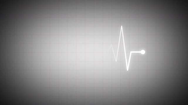 Clean white ECG waveform with round endpoint on soft gray grid background, minimal medical pulse graphic for healthcare monitoring, diagnostics, UI visuals, and clinical presentations in 4K.