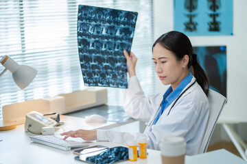 female doctor in white coat reviewing a patient chest X-ray film holding it up against the light in bright modern clinic office.Concept of medical diagnosis,radiology,healthcare,professional analysis