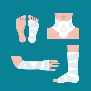 Plaster cast on leg, arm and neck, crutches, bondage on body. Injury, treatment and recovery concept. Rehabilitation after trauma. Collection of body parts with gypsum.