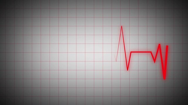Red cardiogram waveform animation on gray grid background. Medical monitoring visual for healthcare technology, cardiology systems, clinical interfaces, digital diagnostics, and data visualization.