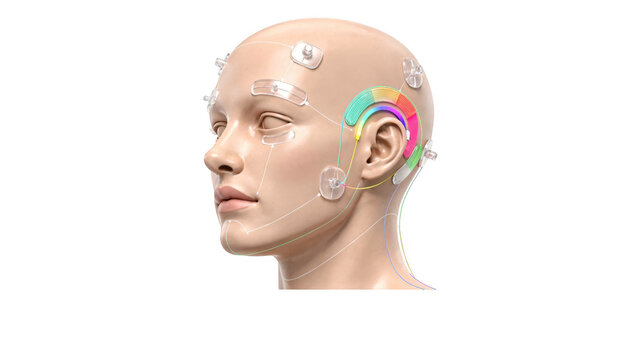 Closeup of a highresolution screen displaying a 3D head model with AIgenerated optimal transducer positions for bone conduction fitting in a clinical workstation environment.