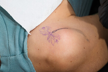 Detail of the process of tattooing a dragonfly on the shoulder in black ink.