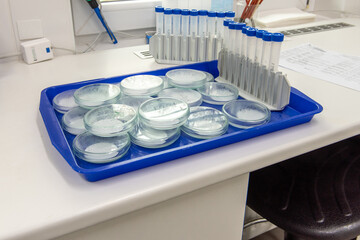 Microbiology laboratory equipment on a white table.