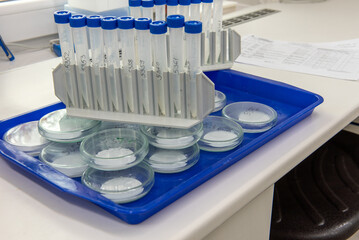 Microbiology laboratory equipment on a white table.