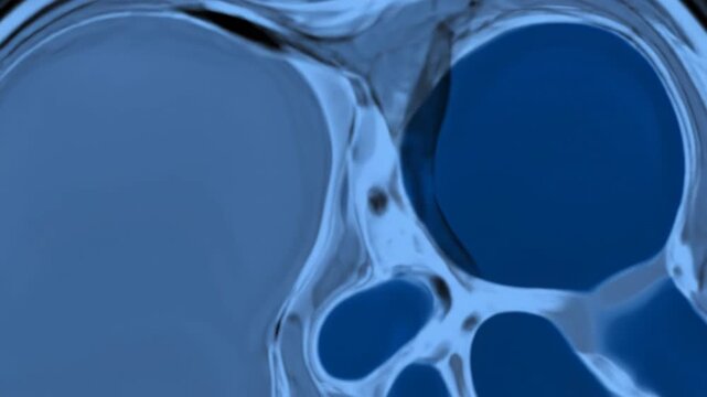 Abstract blue medical scan reveals intricate details of the human skull.  This digital artwork explores the beauty of internal anatomy.