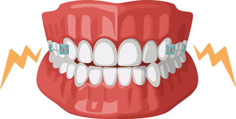 Obraz premium Dental Braces on Human Teeth Vector Illustration for Orthodontic Treatment Healthcare Stomatology Dentist Clinic Oral Hygiene and Medical Health Concept