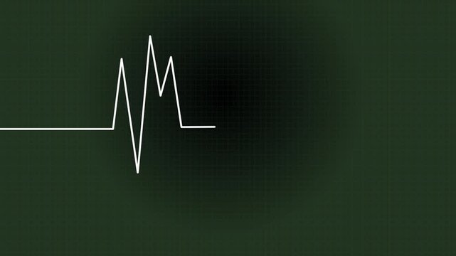 Heartbeat monitor rendering in Adobe AE