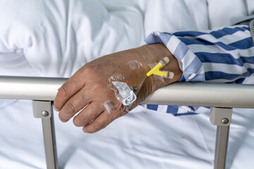 An elderly patient’s hand resting on a hospital bed rail,  with an intravenous cannula secured by medical tape in China. Concept of intravenous therapy, patient care, and hospital treatment procedures
