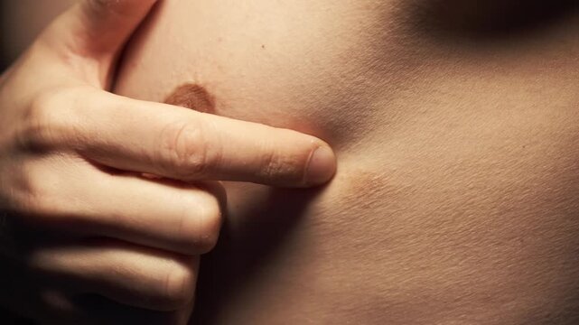 A rash on a person's skin.
A close-up of a man's nipple.
A person scratching a spot on his skin.
Health problems and an itchy red rash on the bare skin.