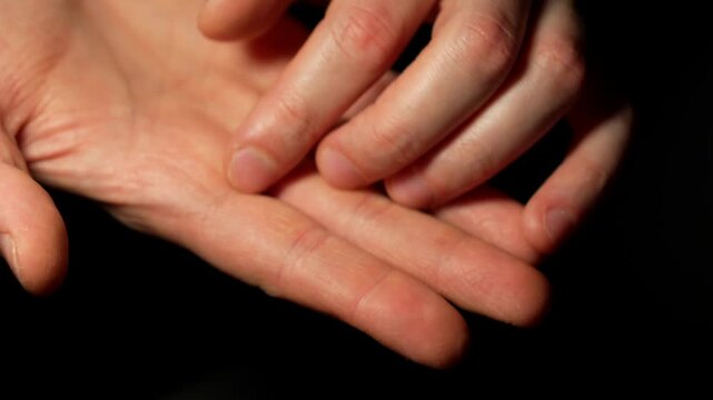 Dry skin on a man's palms.
A person experiences dyskinesia due to dry hands.
Skin conditions on the body.
Allergies and dryness.
Eczema, dermatitis, doctor, hand, body, palm