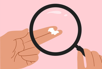 Vaginal discharge symptoms, medical concept of yeast infection, bacterial vaginosis and female reproductive health. Abnormal discharge vector illustration