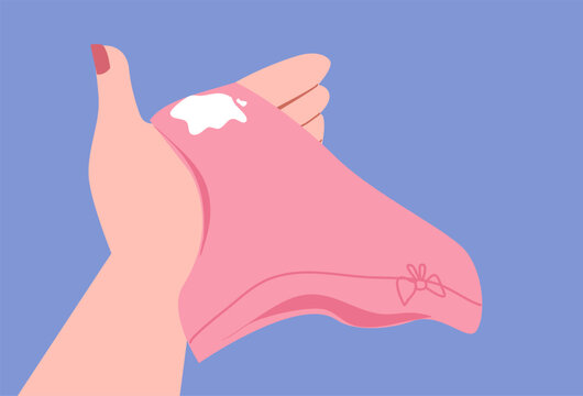 Vaginal discharge symptoms, medical concept of yeast infection, bacterial vaginosis and female reproductive health. Abnormal discharge vector illustration