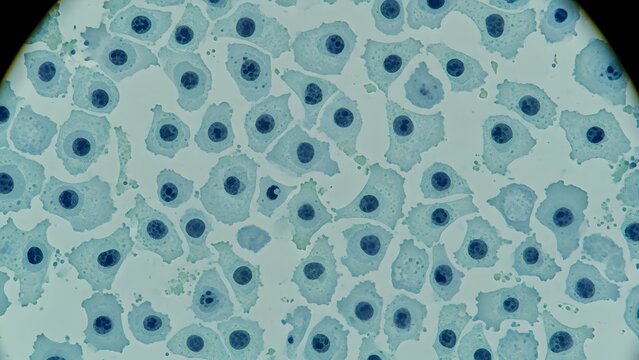 Microscopic view of human cells with visible nuclei. Biology research and medical laboratory science. Close up of stained cellular structure under microscope for pathology and education