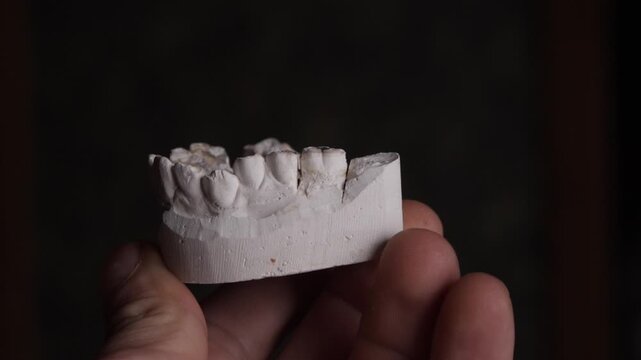 plaster model of the jaw with teeth in the hands of a dentist