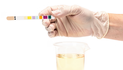 Isolated educators hand demonstrating urine dipstick technique against plain white background focusing on practical skills for health workshop participants.