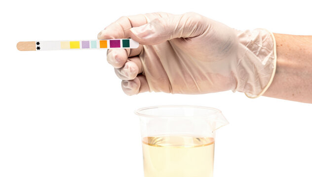 Isolated educators hand demonstrating urine dipstick technique against plain white background focusing on practical skills for health workshop participants.