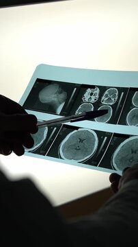 MRI scan. Image of a head. Doctor in a white coat. Slow motion video. Vertical video.High quality 4k footage
