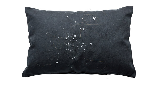 Overhead closeup of dark pillowcase with visible white flakes and loose hair emphasizing scalp health and hygiene in a clinical setting.