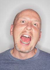 Young man with dental braces opening his mouth wide, closeup portrait
