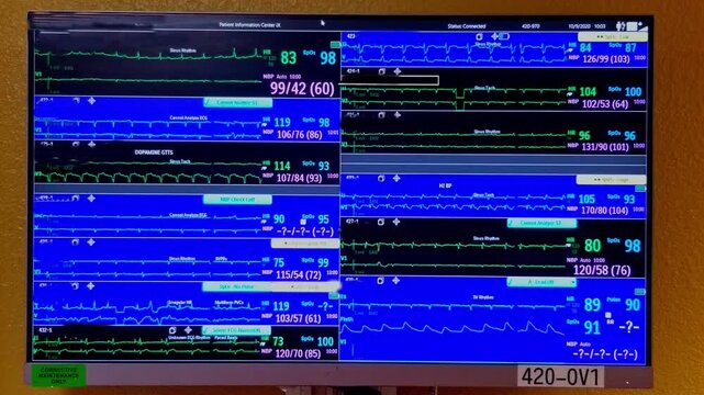 EKG, Pulse, BP and Respiration Multi-patient ICU Monitor Screen