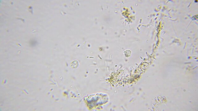Two unicellular sun organisms (Heliozoa) side by side with a few surrounding bacteria under 2000x brightfield microscopy with immersion oil. Detailed microscopic view.