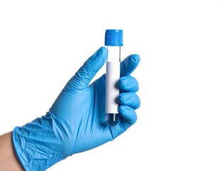 A gloved hand holds a clear, cylindrical tube with a blue cap and a white label, isolated against a white background