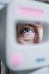 Professional Patient Eye Examination with Fundus Camera Modern Medical Diagnostics for Healthcare Advertising and Ophthalmology Services