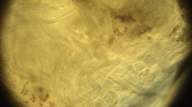 1000X Oil Immersion Microscopic Look at Inner Workings of Aeolosoma Worm Digestive System