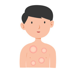 leprosy disease concept. vector illustration