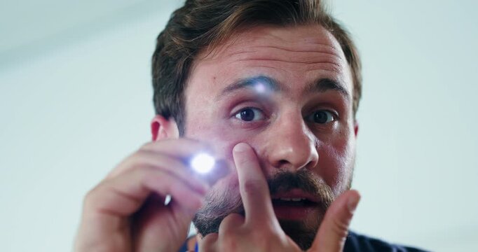 Eye test, light and doctor with face of man in hospital for pupil reflex, concussion check and healthcare pov. Optic nerve damage, consulting and medical help with person and penlight in clinic