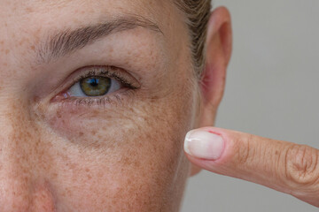 Close-up of a middle-aged woman's eye with wrinkles, pointing at crow's feet