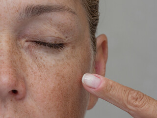 Close up cropped view of a middle aged woman pointing at wrinkles around her closed eye