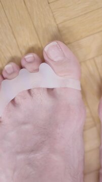 Feet with soft silicone toe corrector fixing hallux valgus person POV