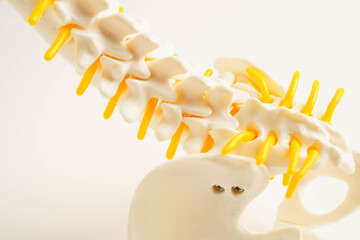 Spinal nerve and bone, Lumbar spine displaced herniated disc fragment, Model for treatment medical in the orthopedic department.