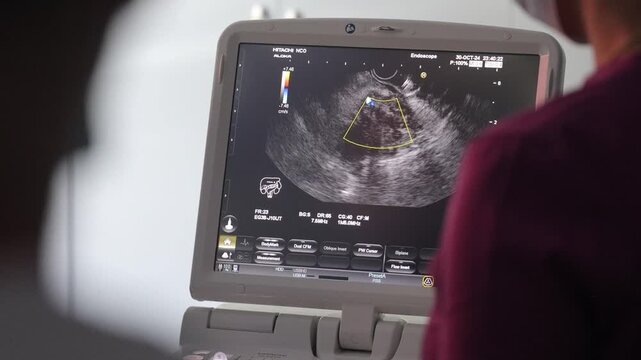 Close-up footage of a medical ultrasound machine screen showing a real-time scan. The monitor displays grayscale imaging. Ideal for use in  healthcare, medical, and hospital-related content.