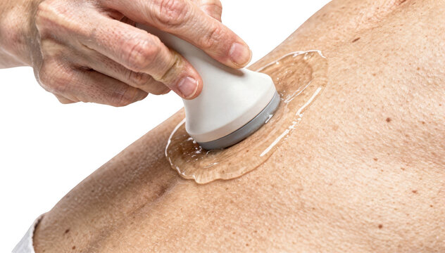 Closeup of a sonographers hand applying gel with an ultrasound probe on a patients right upper abdomen showing detailed scanning procedure on a bright white background.