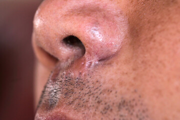 Fototapeta premium Close-Up View of Human Nose and Facial Hair with Natural Texture