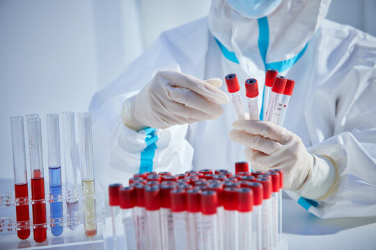 Researcher Examining Blood Samples in Laboratory Testing - Powered by Adobe