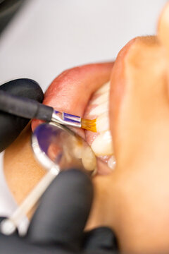 Dental professional applying tooth treatment in clinic