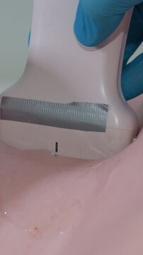 ultrasound probe on neck vein emergency clinician uses transducer with gel to locate vessel for central access, sterile gloved hand steadies probe, Doppler flow assessment and lumen visualization