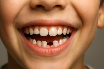 Fototapeta premium Smiling boy with missing tooth