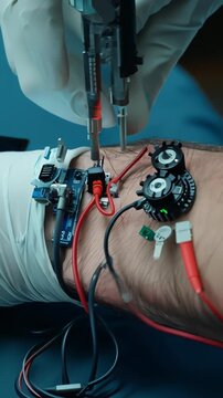 Robotic device cauterizing forearm wound with precision electrodes and sparking, Robotic electrosurgical instrument cauterizes forearm wound using controlled sparks and sterile equipment