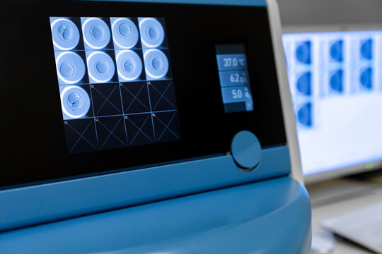 Advanced IVF laboratory technology displaying human embryo development stages on digital screen, fertility clinic incubator monitoring blastocyst growth, assisted reproductive in vitro fertilization