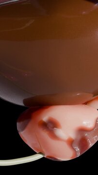 Prostate cancer stages. ancerous cells, malignant tumor compresses urethra. Pathological disruption, genital reproductive system anatomy, bladder Oncological or Urological Disease, bph, 3d render