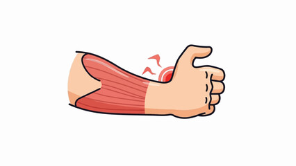 Stylized illustration of a hand with visible forearm muscles and a painful thumb area