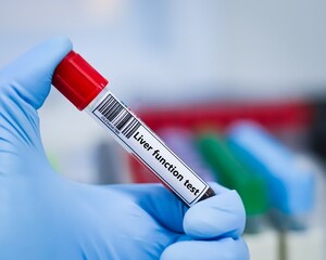 Obraz premium Blood sample tube for liver function test test analysis.