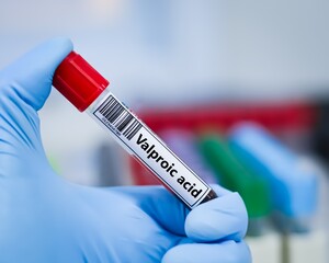 Obraz premium Blood sample tube for vaproic acid test analysis.