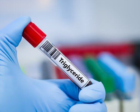 Blood sample tube for triglyceride test analysis.