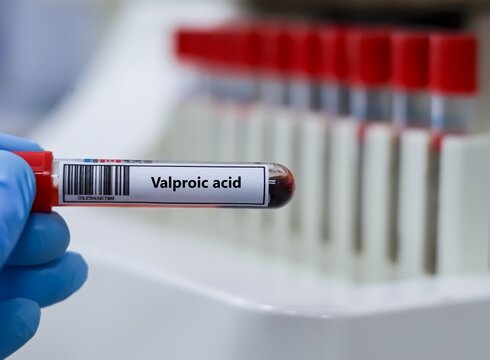 Blood sample tube for vaproic acid test analysis.